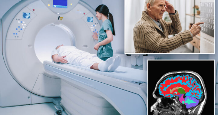 New MRI Tool Predicts Aging Speed and Dementia Risk